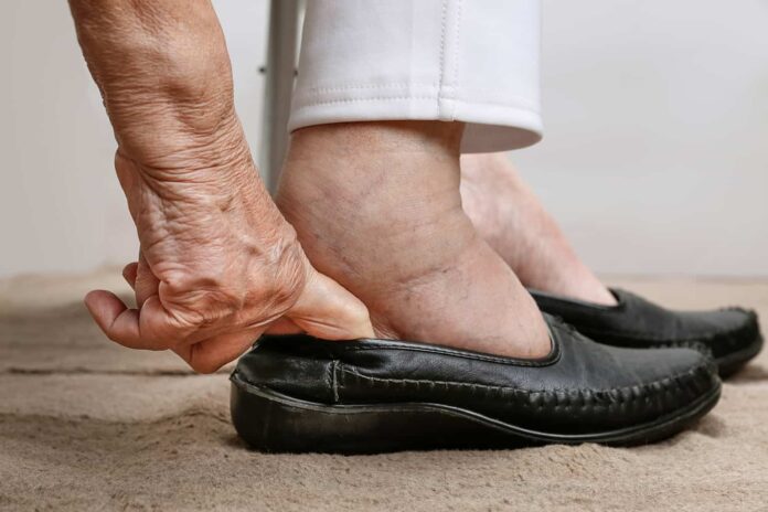 Medical slippers for Swollen Feet